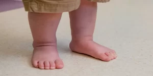 Flat feet or flat feet