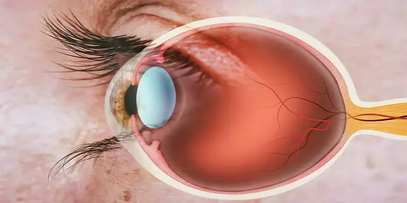 The most important complications resulting from high blood pressure and retinopathy