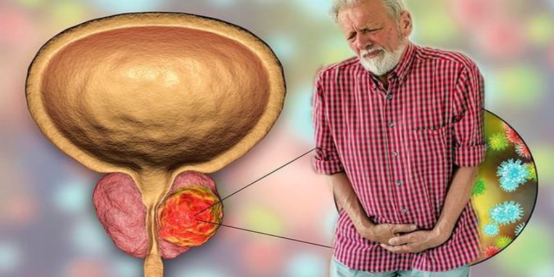 The most important early signs that indicate that the prostate is affected by fibroids
