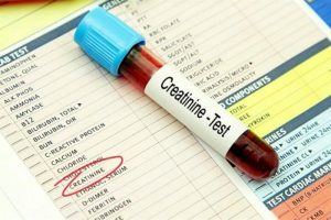 Causes of high creatinine levels
