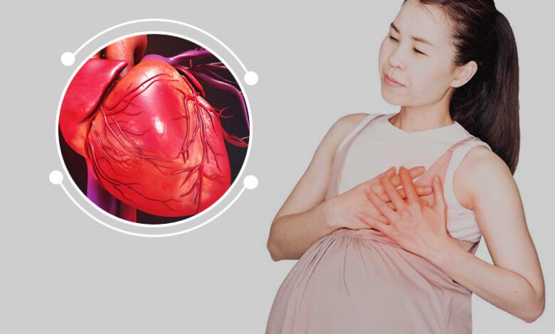 اعتلال عضلة القلب أثناء الحمل